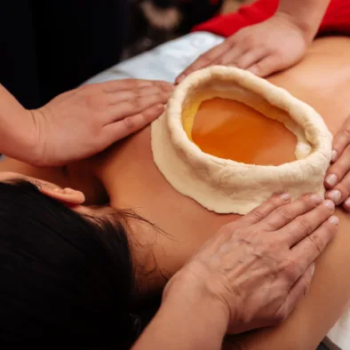 An image of a person receiving a Kativasthi Ayurveda treatment, where warm medicated oil is held within a boundary created on their lower back using dough, helping to alleviate back pain and promote relaxation.