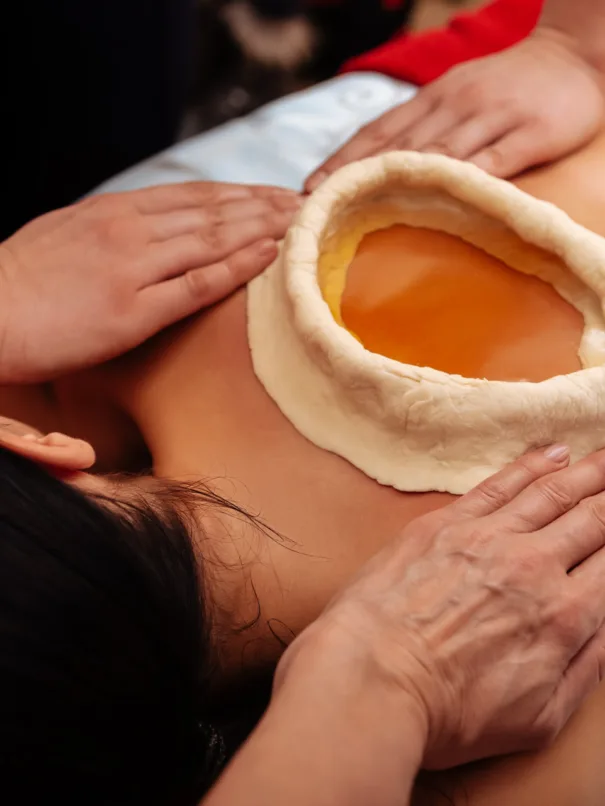 An image of a person receiving a Kativasthi Ayurveda treatment, where warm medicated oil is held within a boundary created on their lower back using dough, helping to alleviate back pain and promote relaxation.